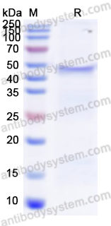 Recombinant Human VEGFC Protein, N-His