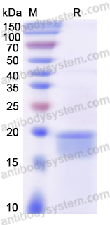 Recombinant Human PSEN1/Presenilin-1 Protein, N-His