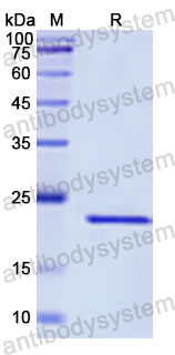 Recombinant Human EIF2B2 Protein, N-His