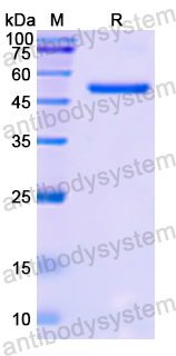 Recombinant Human NUP153 Protein, N-GST