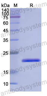 Recombinant Human RGS4 Protein, N-His