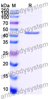 Recombinant Human GSK3A Protein, N-His