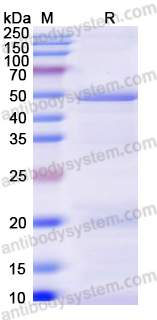 Recombinant Human GSK3B Protein, N-His