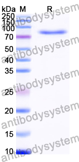 Recombinant Human GSK3B Protein, N-GST