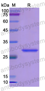 Recombinant Human GZMK Protein, N-His