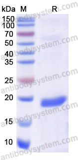Recombinant Human DIO1 Protein, N-His