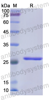 Recombinant Human SELENOP Protein, N-His