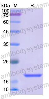 Recombinant Human CAMP Protein, N-His