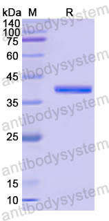 Recombinant Human CD39/ENTPD1 Protein, N-His