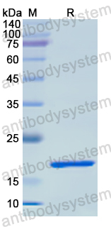 Recombinant Human RBP2 Protein, N-His