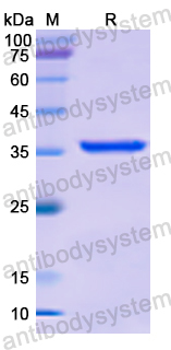 Recombinant Human SULT1A1 Protein, N-His