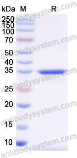 Recombinant Human CRIP1 Protein, N-GST