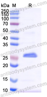 Recombinant Human MMP14 Protein, N-His