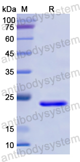 Recombinant Human EMD Protein, N-His