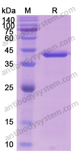 Recombinant Human CPT1A Protein, N-His