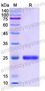 Recombinant Human DNM2 Protein, N-His