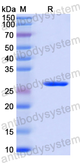 Recombinant Human DNM2 Protein, N-His