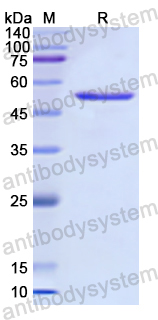 Recombinant Human METAP2 Protein, N-His