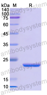 Recombinant Human CD253/TNFSF10/TRAIL Protein, N-His