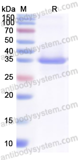 Recombinant Human CDK9 Protein, N-His