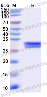 Recombinant Human RORC/NR1F3/RORgT Protein, N-His