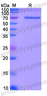 Recombinant Human DNA2 Protein, N-His