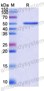 Recombinant Human ALDH3A2 Protein, N-His