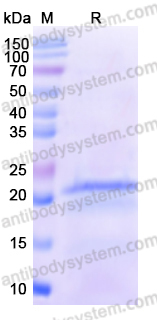 Recombinant Human CCL11/Eotaxin Protein, N-His-SUMO