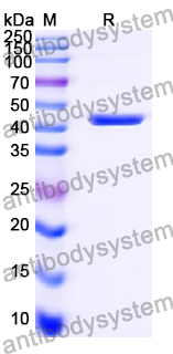 Recombinant Human SUOX Protein, N-His