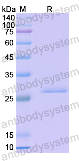 Recombinant Human CNN1 Protein, N-His-SUMO