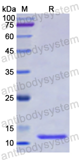 Recombinant Human NEK2 Protein, N-His