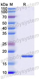 Recombinant Human ARHGDIB Protein, N-His