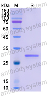Recombinant Human STAT2 Protein, N-His