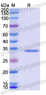 Recombinant Human MSH6 Protein, N-His