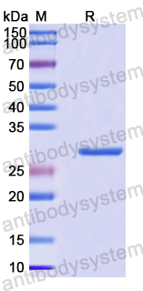 Recombinant Human EFNA3 Protein, N-His-SUMO