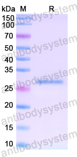 Recombinant Human LIMK1 Protein, N-His