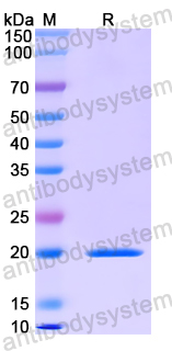 Recombinant Human TERF1 Protein, N-His