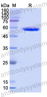 Recombinant Human EPHB4 Protein, N-His