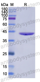 Recombinant Human ADAR/IFI4 Protein, N-His
