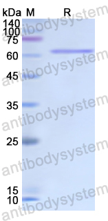 Recombinant Human LAMB2 Protein, N-GST