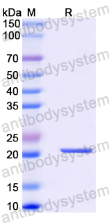 Recombinant Human FOXA3 Protein, N-His-SUMO
