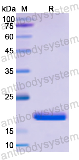 Recombinant Human AP1S2 Protein, N-His