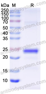 Recombinant Human ATP5ME Protein, N-His-SUMO