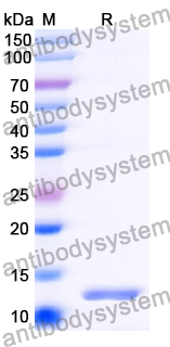 Recombinant Human CLDN18/Claudin-18 Protein, N-His