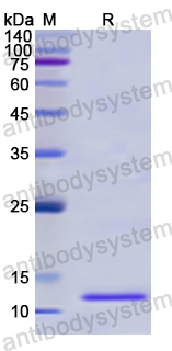 Recombinant Human CD81 Protein, N-His