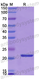 Recombinant Human CD81 Protein, N-His-SUMO