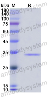 Recombinant Human PLP1 Protein, N-GST & C-His