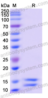 Recombinant Human IL2 Protein, C-His