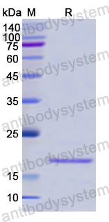Recombinant Human MYL6 Protein, N-His
