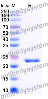 Recombinant Human RAC3 Protein, N-His